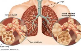 فرایند پرستاری در اختلالات سیستم تنفسی
